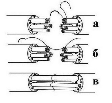 Сшивание пучка нервных волокон с применением тончайших танталовых нитей